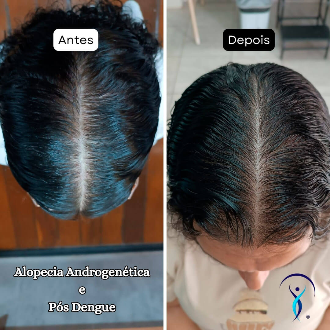 Seus-Cabelos-EStão-Caindo-antes-e-depois